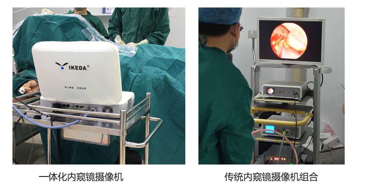 什么是一體化內窺鏡攝像機？